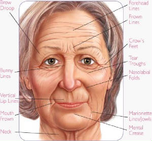 wrinklechart.jpg